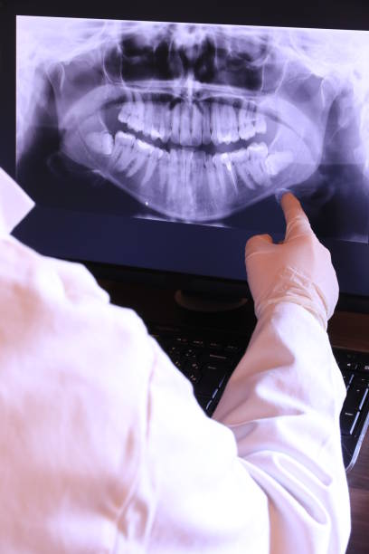 Best Emergency Dental Care for Sports Injuries in Nesquehoning, PA